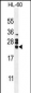 CSF2 Antibody (Center)